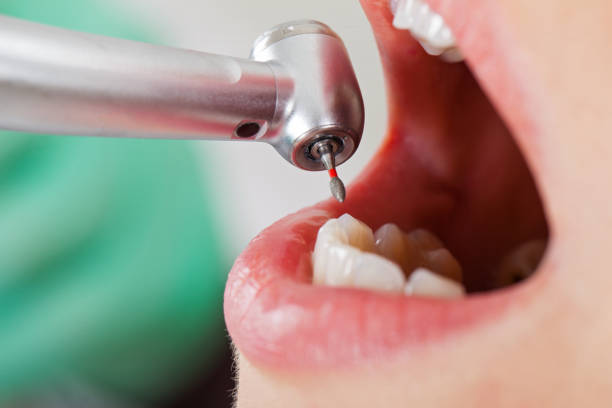 Best Emergency Dentist for Special Needs Patients in Grapeland, TX